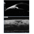 Microscopio de biomicroscopia ultrasonido para los ojos.